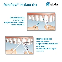 Флосс miradent Mirafloss Implant chx 1,8 мм, хлоргексидин 0,2%, для имплантов/брекетов