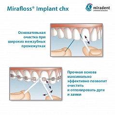 Флосс miradent Mirafloss Implant chx 1,8 мм, хлоргексидин 0,2%, для имплантов/брекетов